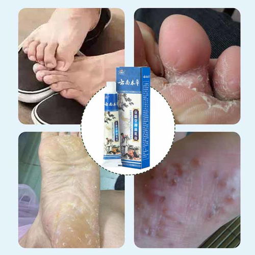 康净卫生用品 专业止痒喷剂厂家在线咨询，您的个人卫生守护者